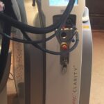 Lutronic Clarity NdYag Alexandrite Laser