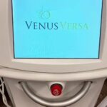 Venus Versa Venus Concepts