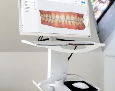 Medit i500 Intraoral Scanner
