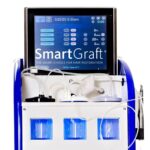 Vision Medical Smartgraft FUE Hair Transplant